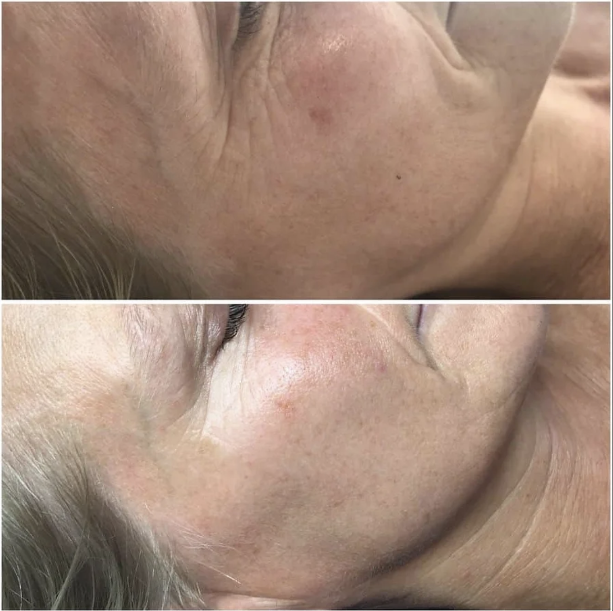 Add-On Treatments