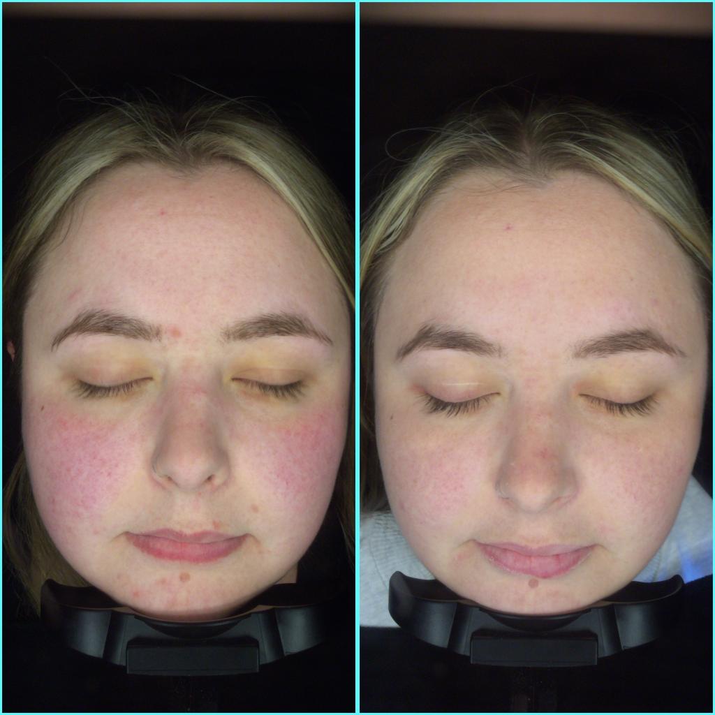 Laura providing personalised skin advice to a client